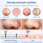 Blackhead Suction Shrink Pores Electric Deep Cleaning Inductive Therapeutical Instrument