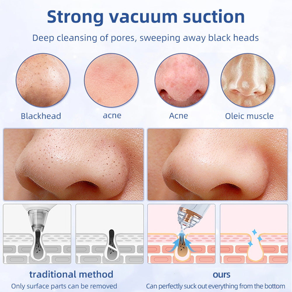 Blackhead Suction Shrink Pores Electric Deep Cleaning Inductive Therapeutical Instrument
